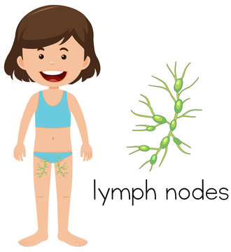 Girl with placement of lymph nodes