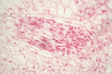 Root bacteria nodules under the microscope.