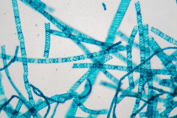 Spirogyra alga under the microscope