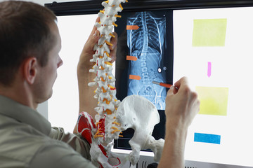  expert with  model  of spine watching image of chest  at x-ray film viewer. 
Scoliosis -...