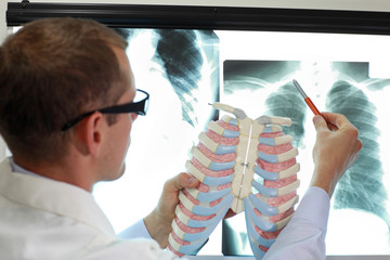doctor with ribs and lungs model watching image of chest at x-ray film viewer