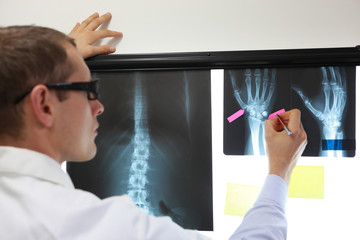 professional making notes,working with images of hands and fingers at x-ray film viewer