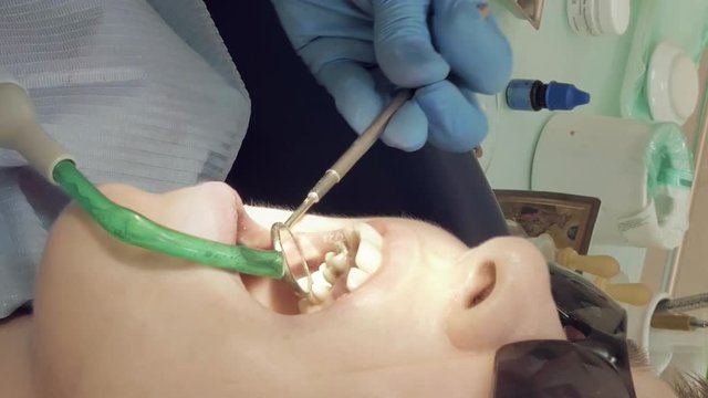 Woman at the dentist clinic office gets dental medical examination and treatment. Close up shot. Odontic and mouth health is important part of human life dentistry help with. Vertical format video.