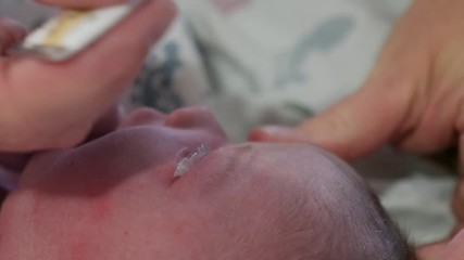A doctor puts antibiotic ointment into a newborn babies eyes