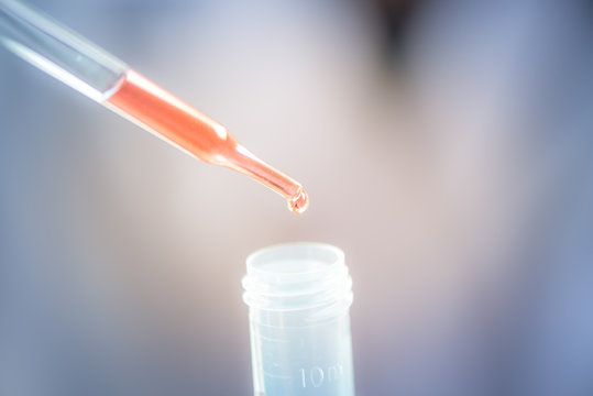 Pipette dropping a sample into a test tube, closeup