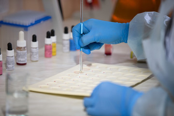 Blood test.Microbiological examination of blood