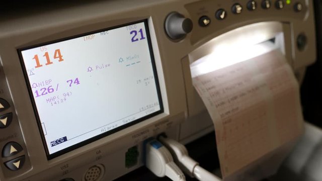 Machine at the hospital to measure a babies heart beat