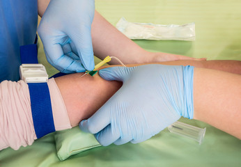 Nurse taking blood sample from a vein of a child