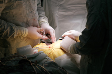 surgeons operating during cardiac operation of CABG