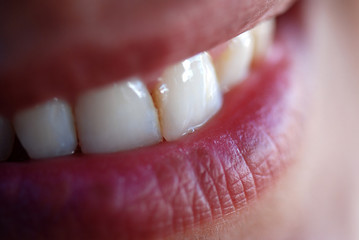 Fototapeta premium MACRO DE UNA BOCA