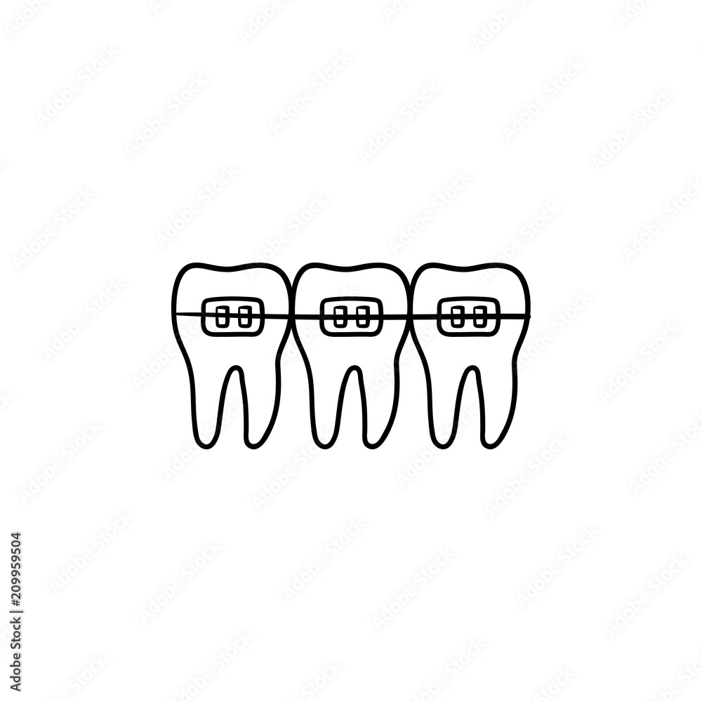 Wall mural dental braces hand drawn outline doodle icon. dentistry, stomatology and orthodontist concept. vecto