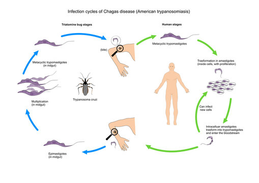 Chagas disease, or american trypanosomiasis, a tropical parasitic disease.