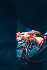 Close up of open heart surgery cardiopulmonary bypass, minimal invasive cardiac surgery,...