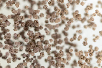 Rhizopus (bread mold) is a genus of common saprophytic fungi,Rhizopus (bread mold) under the microscope.