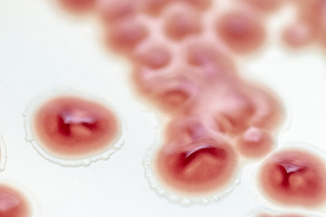 Serratia marcescens is a species of rod-shaped gram-negative bacteria in the family Enterobacteriaceae for Laboratory microbiology.