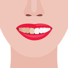 Face girl. Smile with dirty and clean teeth. Vector illustration