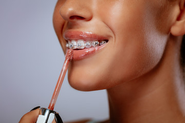 Smiling young woman with braces applying lip gloss on her lips.