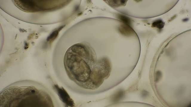 moving the eggs Snails Planorbis in time laps, under a microscope