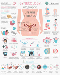 Uterine fibroids. Ginecological medical desease in women infographic - obrazy, fototapety, plakaty