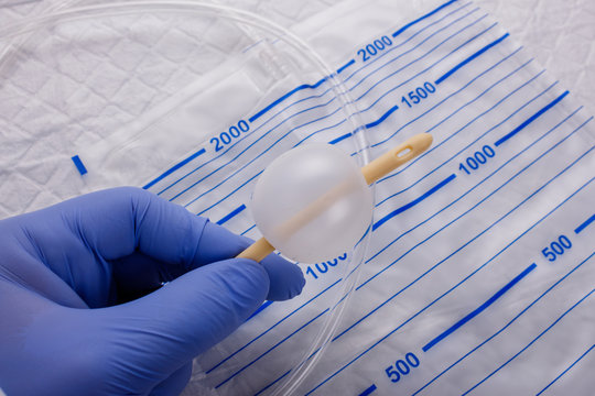 Nurse inflates urinary catheter bulb with leg drainage bag on sterile field.