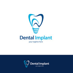 Dental Implant Logo Design Template