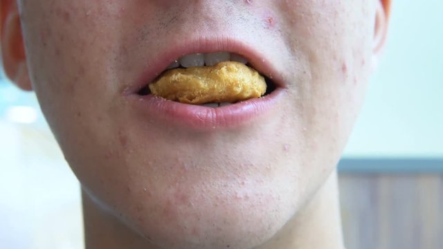 A young man with pimples on his face eats chicken nugget in a fast food restaurant.