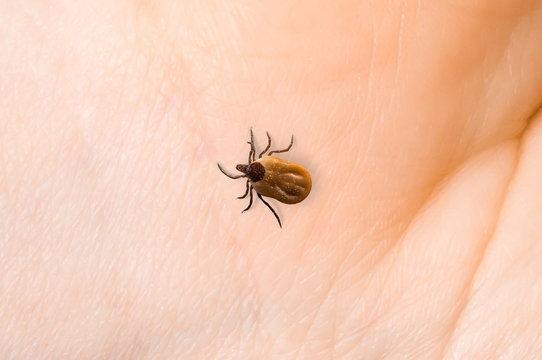 Tick is crawling on human body skin