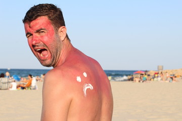 Sunburned man with lots of pain 