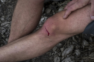 Cut on the knee after falling on a rock