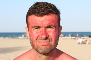 Man getting sunburned at the beach