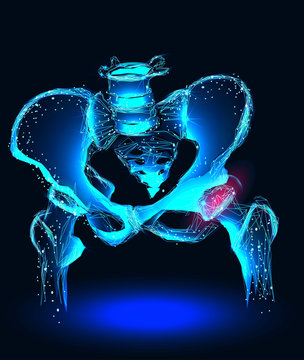Arthritis at hip joint. Banner. Abstract image of a starry sky or space, consisting of points, lines, and shapes in the form of planets, stars and the universe. Low poly vector