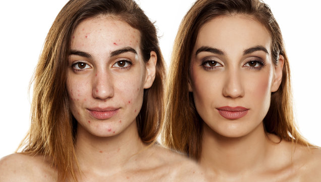 comparition portrait of same woman before and after cosmetic treatment amd makeup on white background