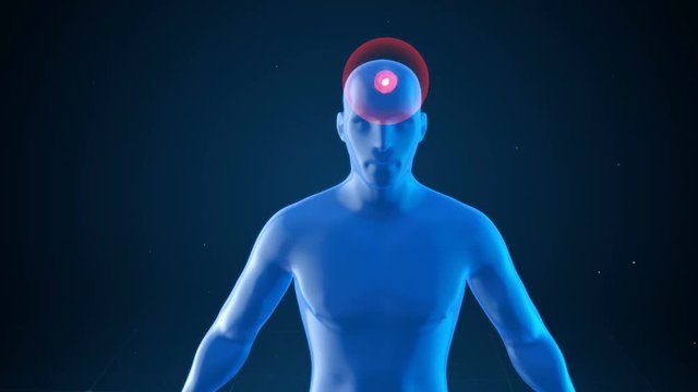 Model of a man with impulses of a headache, medical concept