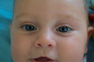 bambina occhi blu su sfondo blu con strabismo di venere © benedetta