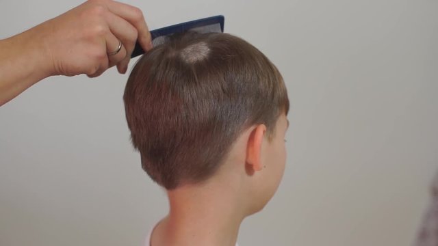 The doctor examines the bald patch on the child's head. Self-isolation, quarantine of viral infection COVID 19. Healthy lifestyle.
