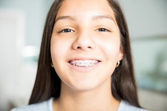 Smiling Teenage Girl Wearing Braces At Dental Clinic