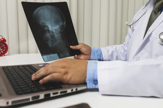 Doctor diagnose and analyze on x-ray film of patient.