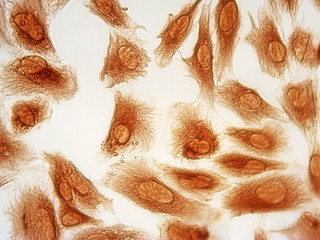 Photomicrograph of human endometrial stromal cells stained immunocytochemically for vimentin...
