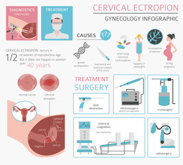 Cervical ectropion. Ginecological medical desease infographic