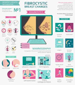 Fibrocystic breast changes disease, medical infographic. Diagnostics, symptoms, treatment. Women`s health icon set