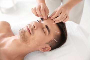 Young man undergoing acupuncture treatment in salon - obrazy, fototapety, plakaty