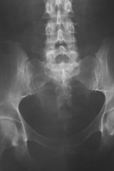 Medical xray spine hip scan