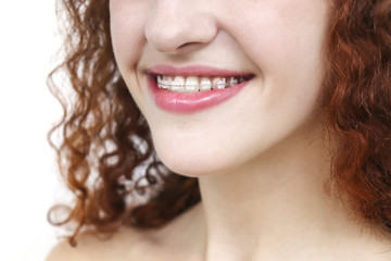 Girl in braces. Young european woman smiling in ceramic braces. Happy smile. Girl with curly red...