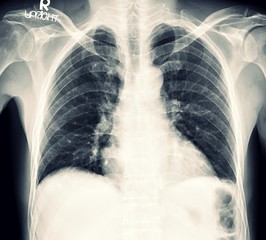 X-ray Any Positioning