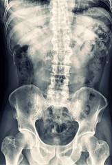X-ray Any Positioning