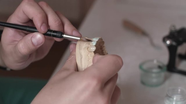 Technician Dentist Makes A Jaw Prosthetic