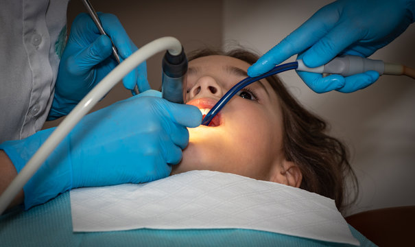 background. professional dental treatment for girls. examination and treatment by a dentist