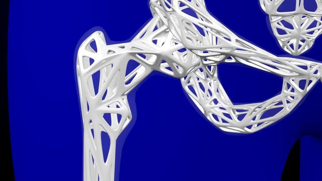 Healthy bone and osteoporosis bone. Loopable. Two luma matte (Skeleton and Body). 3D rendering.