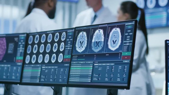 Computer Screen Showing MRI, CT Image Scan of the Brain. In the Background Meeting of the Team of  Medical Scientists in the Brain Research Laboratory. Shot on RED EPIC-W 8K.