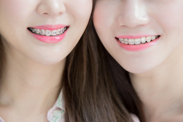 close up of woman tooth